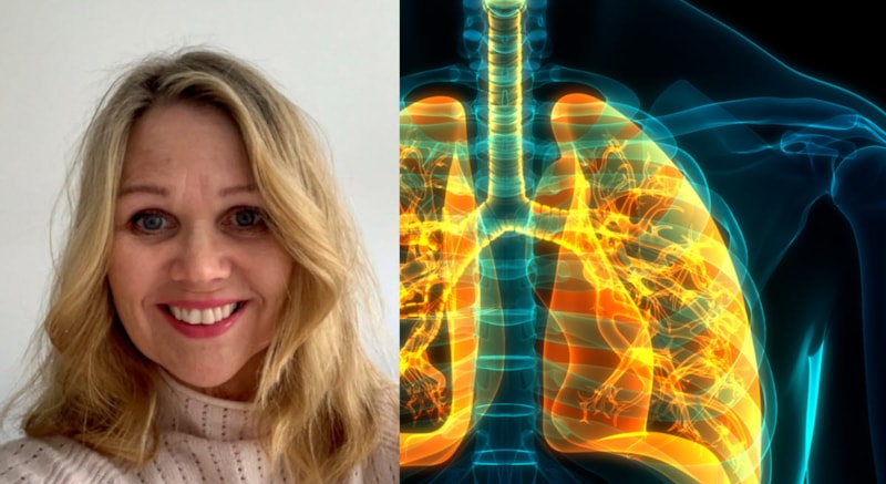 – På verdensbasis er det under ti prosent av pasienter som kan ha nytte av lungerehabilitering, som får det. Det er også et fåtall i Norge, sier Bente Frisk, medlem i Nasjonalt kolsråd. 
