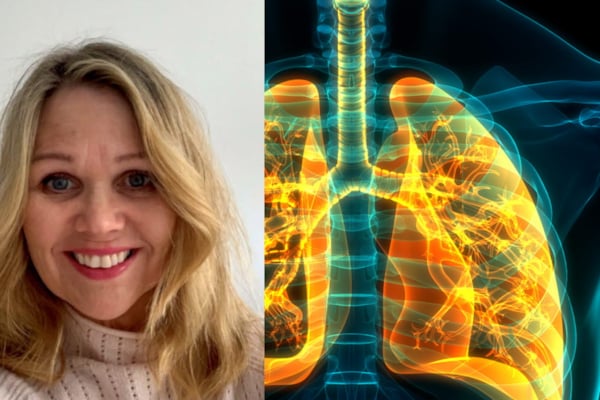 – På verdensbasis er det under ti prosent av pasienter som kan ha nytte av lungerehabilitering, som får det. Det er også et fåtall i Norge, sier Bente Frisk, medlem i Nasjonalt kolsråd. 