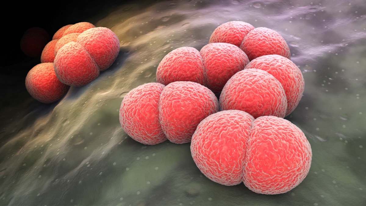 Neisseria meningitidis / meningococcus